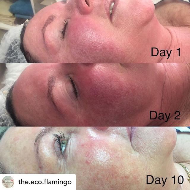 Before & After Photo 29 Before & After Photo 29